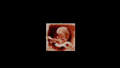 Image for Mini Peek Ultrasound with Peekaboo