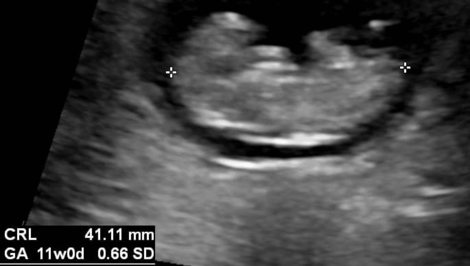 Image for Diagnostic Obstetric Ultrasounds