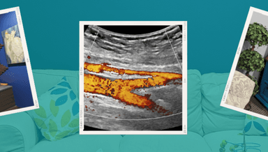 Image for Aorta Screening, CPT 76706. Aorta with AAA, CPT 76775